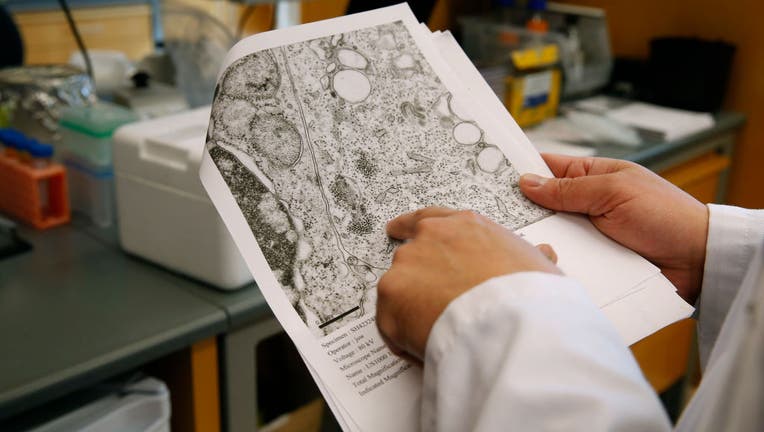 Dr. Charles Chiu reviews microscopic imagery in his lab at the UCSF Mission Bay campus in San Francisco, Calif. on Friday, Feb. 24, 2017. Chiu has published findings on his research about the effects of paralysis in children with the Enterovirus D68 infec