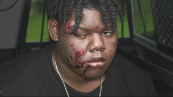 Warren Police defend use of force in arrest of 17-year-old Tyler Wade, said he put officers and public at risk