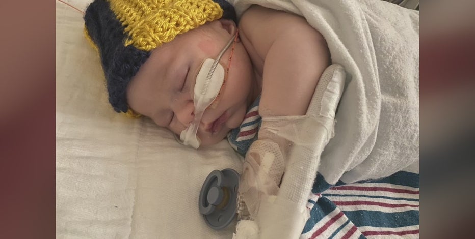 Metro Detroit hospitals see decrease in pediatric RSV cases after spike