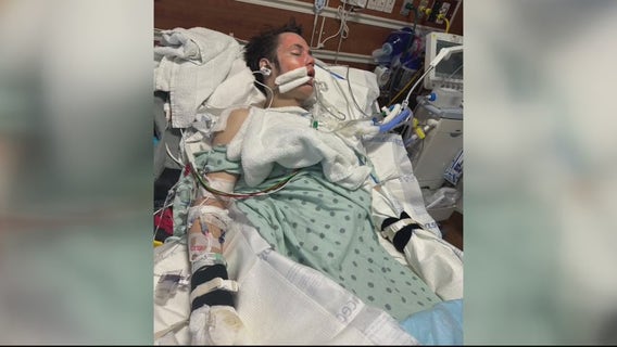 18-year-old man suffers third-degree burns while rescuing neighbors from burning Monroe home