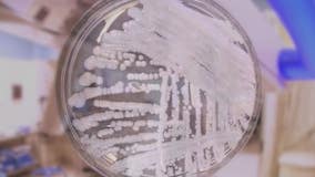 Infectious disease expert: Fungal illness outbreak at UP paper mill spreads through environment