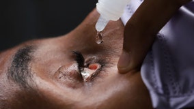 FDA warns against using eye drops with amniotic fluid