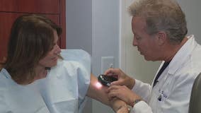 Melanoma Monday: Your skin tells a story of sun damage; full body exams should be yearly