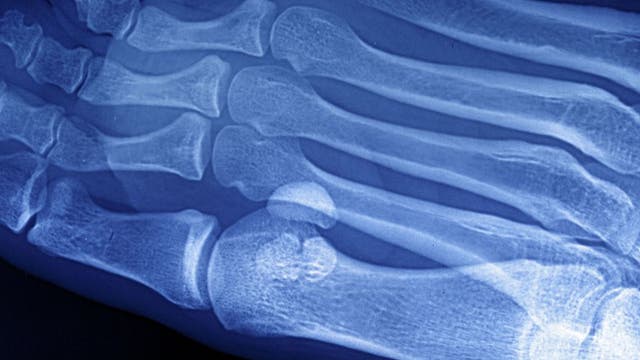 Metro Detroit podiatrist sentenced to prison for submitting nearly $2 million in fake Medicare claims