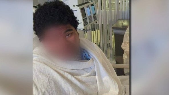 19-year-old saves girlfriend from Detroit house fire by jumping out of window