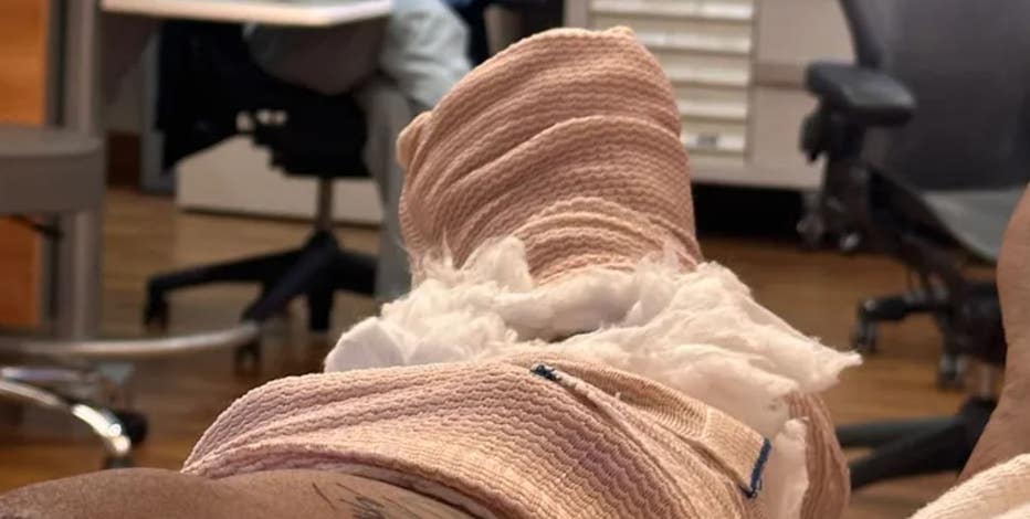 'He never stopped': Woman struck by her own car at Detroit gas station