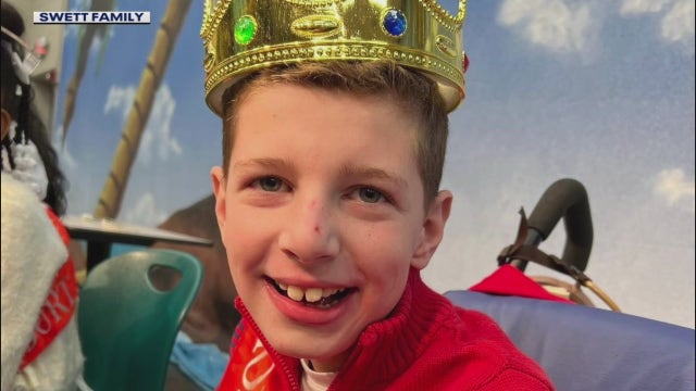 12-year-old epilepsy patient celebrated post life-saving brain surgery