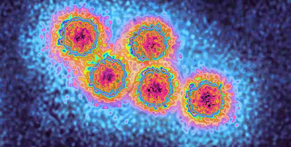 Washtenaw County reports hepatitis A infections found in two residents