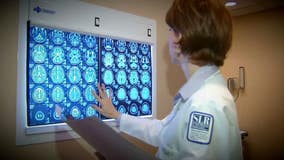 New trend of getting unprompted medical body scans not recommended, say experts