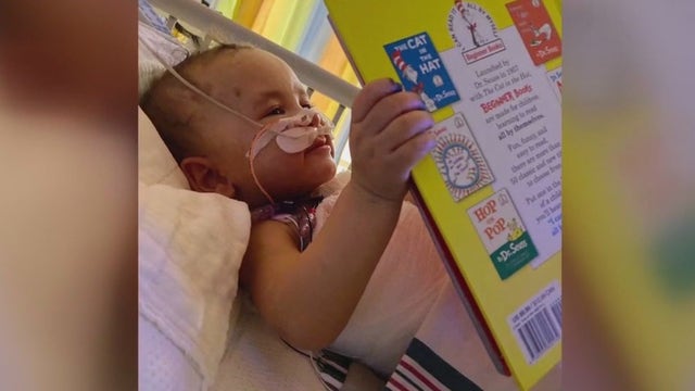 Baby hospitalized for severe injuries, father arrested on child abuse charges