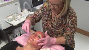 'Vampire facials' linked to HIV cases, CDC warning
