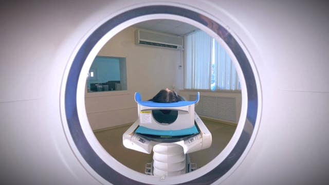 Rise in cancer cases among younger people leads to rise in proactive screenings