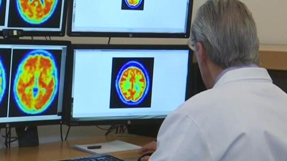 Strokes can damage the brain in seconds, but there can be recovery says doctor