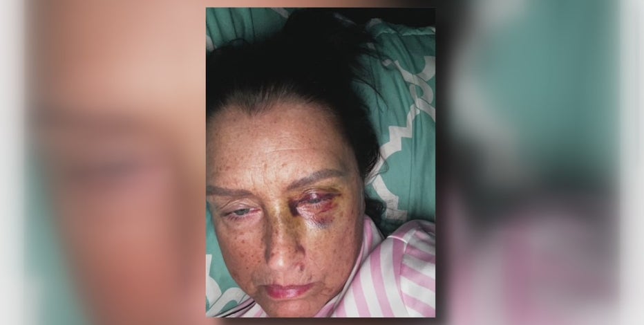 Restaurant manager attacked over lemonade in Livonia, suspect charged