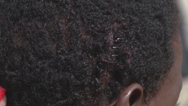 Detroit 8-year-old grazed in drive-by shooting Monday morning