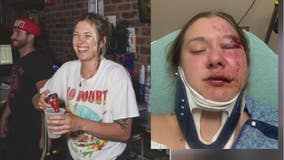 Mount Clemens woman brutally beaten randomly in Detroit