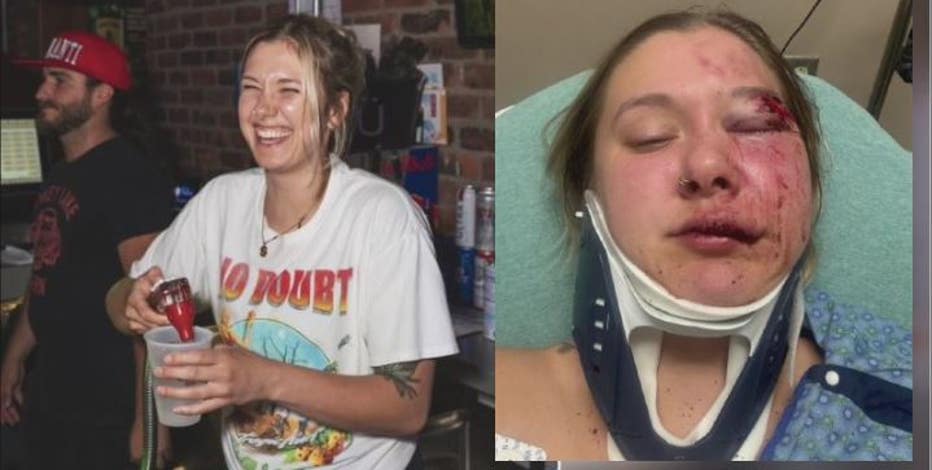 Mount Clemens woman brutally beaten randomly in Detroit