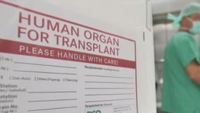 New Michigan law could allow organ donors to claim tax credit for nonmedical expenses