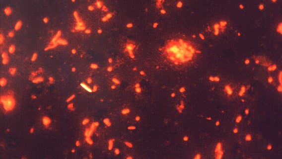 Tuberculosis confirmed in northern Michigan cattle herd is state's first since 2022