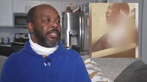 Pontiac man set on fire while sleeping during Facetime prank wants justice