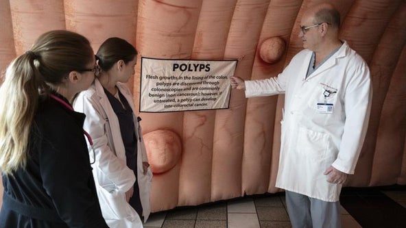 Understanding Colorectal Cancer and the Importance of Colonoscopy: Insights from Corewell Health