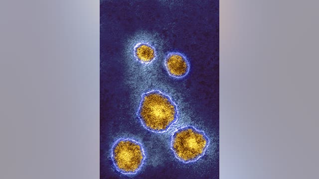 Mumps in Oakland County: Health officials confirm county's first case