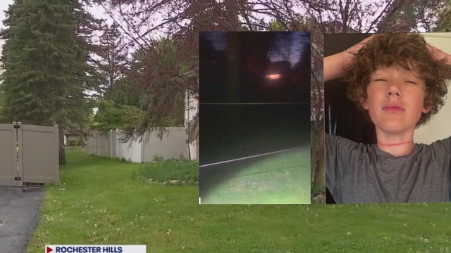 Teen on bike injured by clothesline hung on private property by homeowner