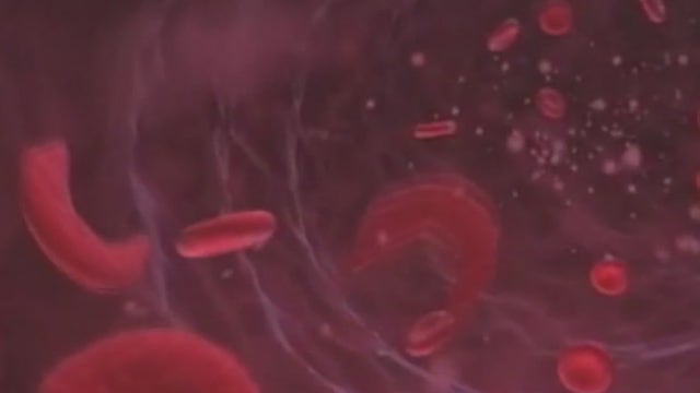 Metro Detroit advocate for sickle cell patients worry about potential Trump cuts