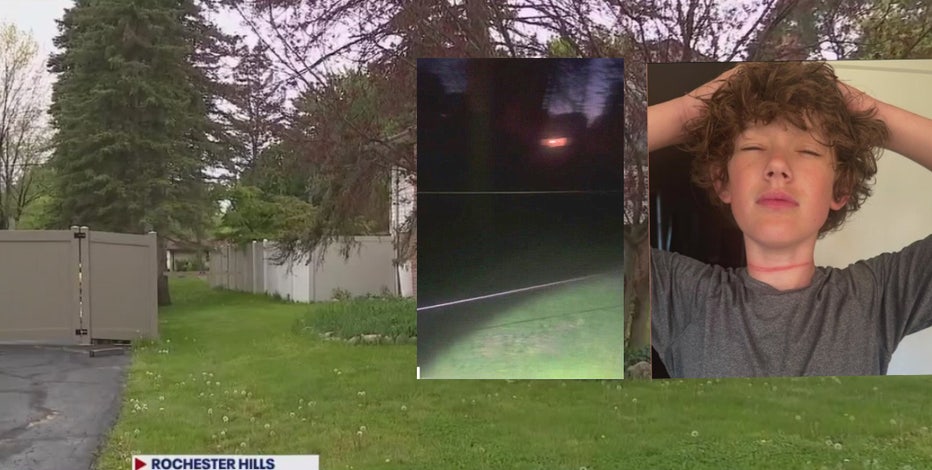 Teen on bike injured by clothesline hung on private property by homeowner
