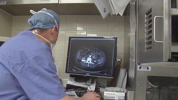 Doctor: Many prostate cancer screenings involve only a blood test