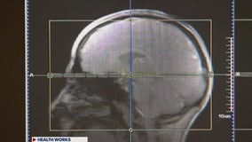 Exercise and Wordle are great ways to reduce dementia risk