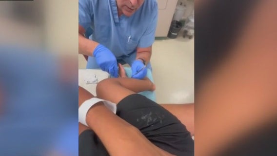 Child injured after stepping on scalding hot Detroit manhole cover