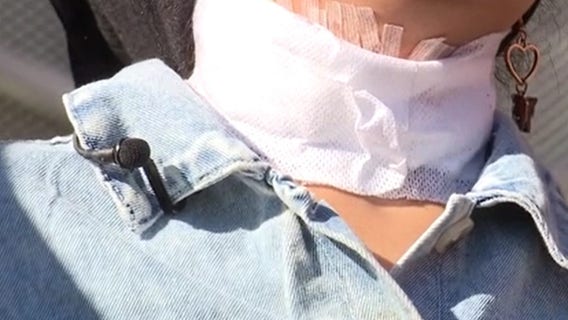 Detroit stabbing victim's family files $50M lawsuit against accused man