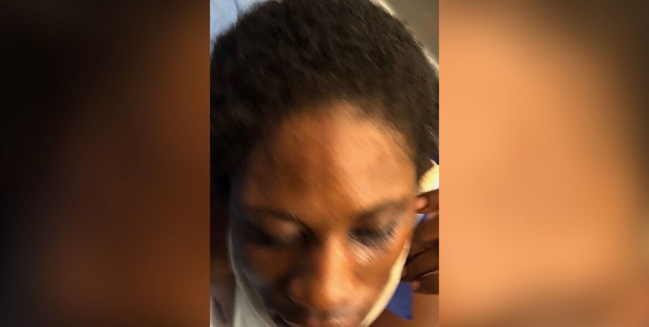 Woman found on I-96: Female discovered with injuries identified by police