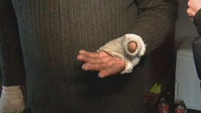 Detroit house hit with Molotov cocktail injuring homeowner: Investigation ongoing