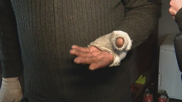 Detroit house hit with Molotov cocktail injuring homeowner: Investigation ongoing