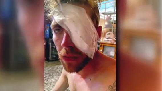 'Like squishing a grape:' Man awarded $4M after suing Clinton Township officer who punched him