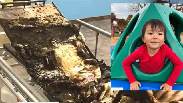 Hyperbaric chamber explosion: No charging decision by judge in 5-year-old's death