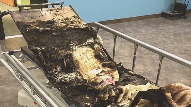 New details revealed in Troy hyperbaric chamber explosion case that killed 5-year-old