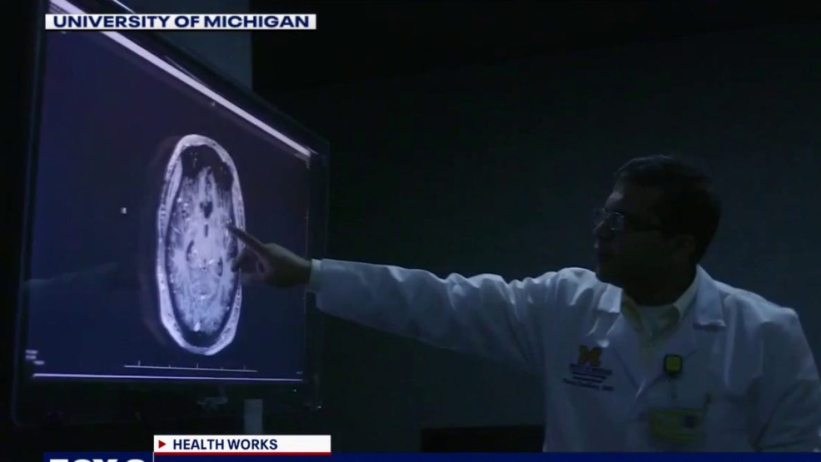 Stroke treatment - why every second counts