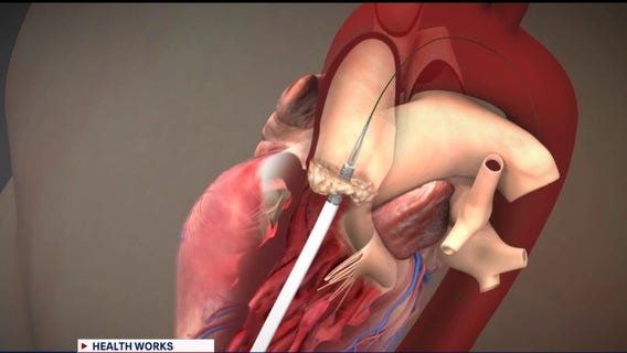 Recognize the signs of heart disease - here's what to look for