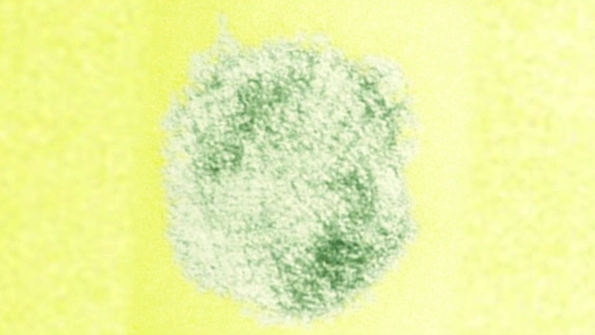 Hantavirus: What is it and how you can prevent it during spring cleaning?