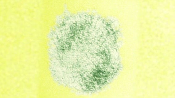 Hantavirus: What is it and how you can prevent it during spring cleaning?