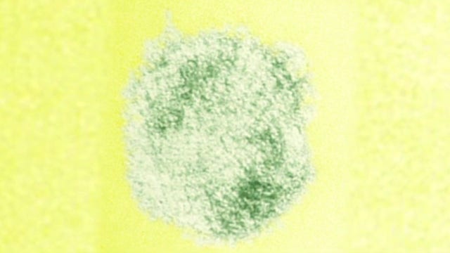 Hantavirus: What is it and how you can prevent it during spring cleaning?