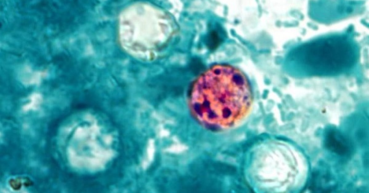 Cyclosporiasis cases on the rise in Monroe County, health officials say