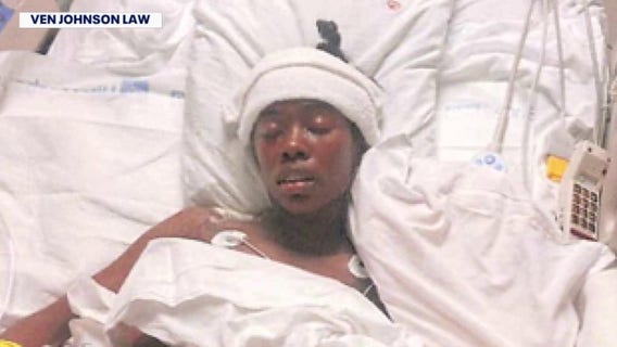 Family of victim in 2024 Detroit shooting at large party sues officer that shot her