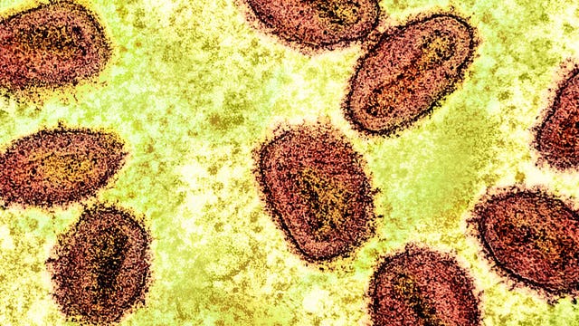 Foreign nationals working at NIH charged with smuggling mpox into US at Metro Airport