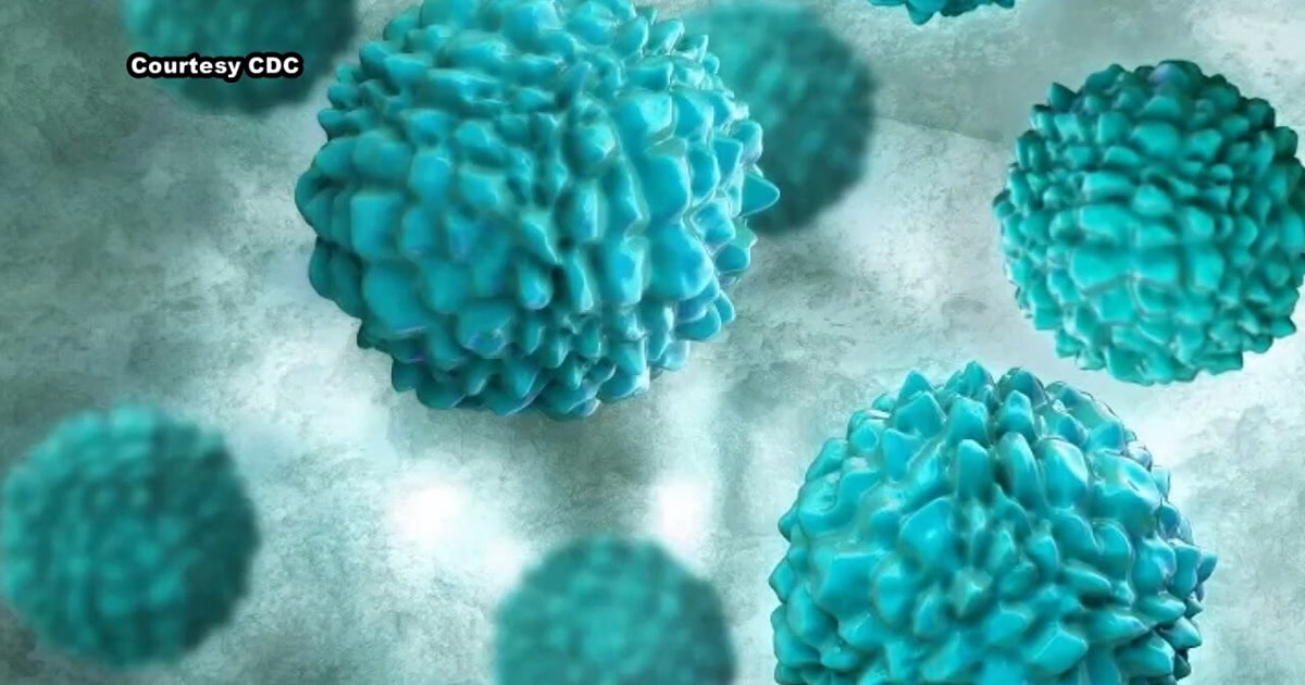 MDHHS disse que o surto de Cyclospora pode estar ligado à alface americana e à alface