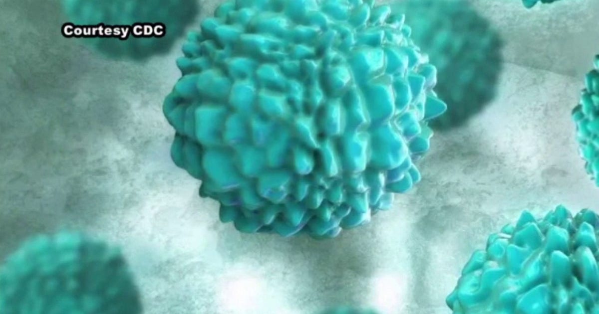 Cyclosporiasis outbreak: Michigan case count tops 1,500