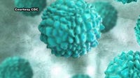Cyclosporiasis outbreak in Michigan: Latest case numbers near 1K mark